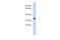 Tripartite Motif Containing 14 antibody, 25-232, ProSci, Western Blot image 