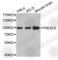 Phosphatidylinositol 3-Kinase Catalytic Subunit Type 3 antibody, A4021, ABclonal Technology, Western Blot image 
