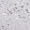 Orthopedia Homeobox antibody, HPA059342, Atlas Antibodies, Immunohistochemistry frozen image 