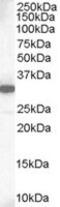 MCL1 Apoptosis Regulator, BCL2 Family Member antibody, MBS420762, MyBioSource, Western Blot image 
