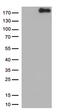 NPHS1 Adhesion Molecule, Nephrin antibody, TA813411S, Origene, Western Blot image 