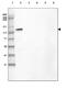 Laminin subunit beta-3 antibody, NBP2-46623, Novus Biologicals, Western Blot image 