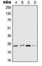 Interleukin 37 antibody, LS-C353395, Lifespan Biosciences, Western Blot image 