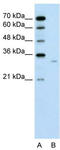 Dicarbonyl And L-Xylulose Reductase antibody, TA344125, Origene, Western Blot image 