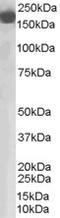 Complement Factor H antibody, EB06848, Everest Biotech, Western Blot image 