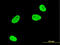 Serum/Glucocorticoid Regulated Kinase 1 antibody, LS-B5534, Lifespan Biosciences, Immunofluorescence image 