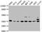 Proteasome 26S Subunit, Non-ATPase 14 antibody, CSB-PA018904OA01HU, Cusabio, Western Blot image 
