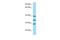 RP9 Pre-MRNA Splicing Factor antibody, A09964, Boster Biological Technology, Western Blot image 