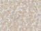 C-C Motif Chemokine Receptor 7 antibody, 7649, ProSci, Immunohistochemistry paraffin image 