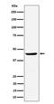 NDRG Family Member 3 antibody, M10017, Boster Biological Technology, Western Blot image 