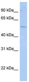 TOR antibody, TA338351, Origene, Western Blot image 