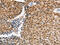 Interferon Regulatory Factor 6 antibody, CSB-PA102246, Cusabio, Immunohistochemistry frozen image 