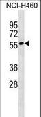 Zinc Finger Protein 302 antibody, LS-C157435, Lifespan Biosciences, Western Blot image 