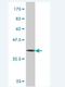 Protein LAP2 antibody, H00055914-M02, Novus Biologicals, Western Blot image 