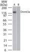 DNA Methyltransferase 3 Alpha antibody, TA336383, Origene, Western Blot image 