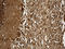 Karyopherin Subunit Beta 1 antibody, LS-C792909, Lifespan Biosciences, Immunohistochemistry paraffin image 