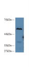 Carboxypeptidase B2 antibody, LS-C299260, Lifespan Biosciences, Western Blot image 