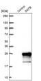 Small Glutamine Rich Tetratricopeptide Repeat Containing Beta antibody, PA5-64128, Invitrogen Antibodies, Western Blot image 