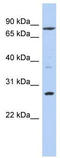Kruppel Like Factor 12 antibody, TA332008, Origene, Western Blot image 