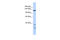 Tankyrase-1 antibody, 25-159, ProSci, Western Blot image 