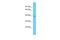 Aurora Kinase A And Ninein Interacting Protein antibody, A14737, Boster Biological Technology, Western Blot image 