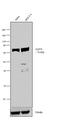Zeta Chain Of T Cell Receptor Associated Protein Kinase 70 antibody, 13-0600, Invitrogen Antibodies, Western Blot image 