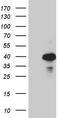 Ornithine Carbamoyltransferase antibody, CF802457, Origene, Western Blot image 