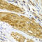 Cyclin Dependent Kinase 6 antibody, 13-257, ProSci, Immunohistochemistry frozen image 