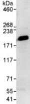 IQ Motif Containing GTPase Activating Protein 1 antibody, ab86064, Abcam, Immunoprecipitation image 