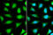 Nucleoporin 153 antibody, GTX132731, GeneTex, Immunocytochemistry image 