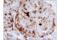 V-Set Domain Containing T Cell Activation Inhibitor 1 antibody, 14572T, Cell Signaling Technology, Immunohistochemistry frozen image 