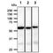 Protein Phosphatase 3 Catalytic Subunit Alpha antibody, GTX57730, GeneTex, Western Blot image 