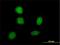 SRY-Box 21 antibody, H00011166-M01, Novus Biologicals, Immunofluorescence image 