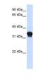 Casein Kinase 1 Alpha 1 antibody, orb330644, Biorbyt, Western Blot image 