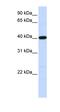 Tropomodulin 3 antibody, orb325957, Biorbyt, Western Blot image 