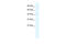 GA Binding Protein Transcription Factor Subunit Beta 1 antibody, 31-228, ProSci, Western Blot image 