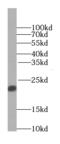 TAGLN2 antibody, FNab08937, FineTest, Western Blot image 