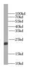 Transgelin 2 antibody, FNab08937, FineTest, Western Blot image 