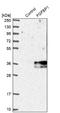 Fibroblast Growth Factor Binding Protein 1 antibody, NBP1-83904, Novus Biologicals, Western Blot image 