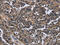 Integrin Subunit Alpha E antibody, CSB-PA939663, Cusabio, Immunohistochemistry frozen image 