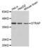 Serine/Threonine Kinase Receptor Associated Protein antibody, abx004575, Abbexa, Western Blot image 