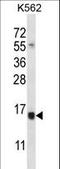 Selenoprotein K antibody, LS-C168944, Lifespan Biosciences, Western Blot image 