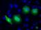 RAB17, Member RAS Oncogene Family antibody, GTX83739, GeneTex, Immunocytochemistry image 