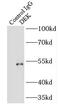 DEK Proto-Oncogene antibody, FNab02329, FineTest, Immunoprecipitation image 