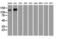 MIC5 antibody, GTX84244, GeneTex, Western Blot image 