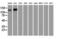 L1 Cell Adhesion Molecule antibody, GTX84244, GeneTex, Western Blot image 