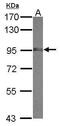 Non-SMC Condensin I Complex Subunit H antibody, PA5-30467, Invitrogen Antibodies, Western Blot image 