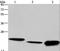 Interleukin 19 antibody, LS-B15812, Lifespan Biosciences, Western Blot image 