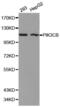 Phosphatidylinositol-4,5-Bisphosphate 3-Kinase Catalytic Subunit Beta antibody, abx000935, Abbexa, Western Blot image 