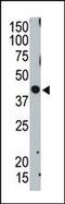 Tumor Susceptibility 101 antibody, 61-117, ProSci, Western Blot image 